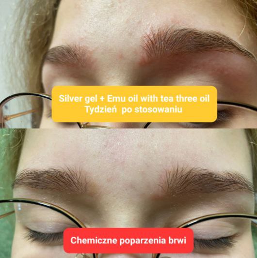 Efekty Silver Gel i Emu Oil with tea three oil Coral Club