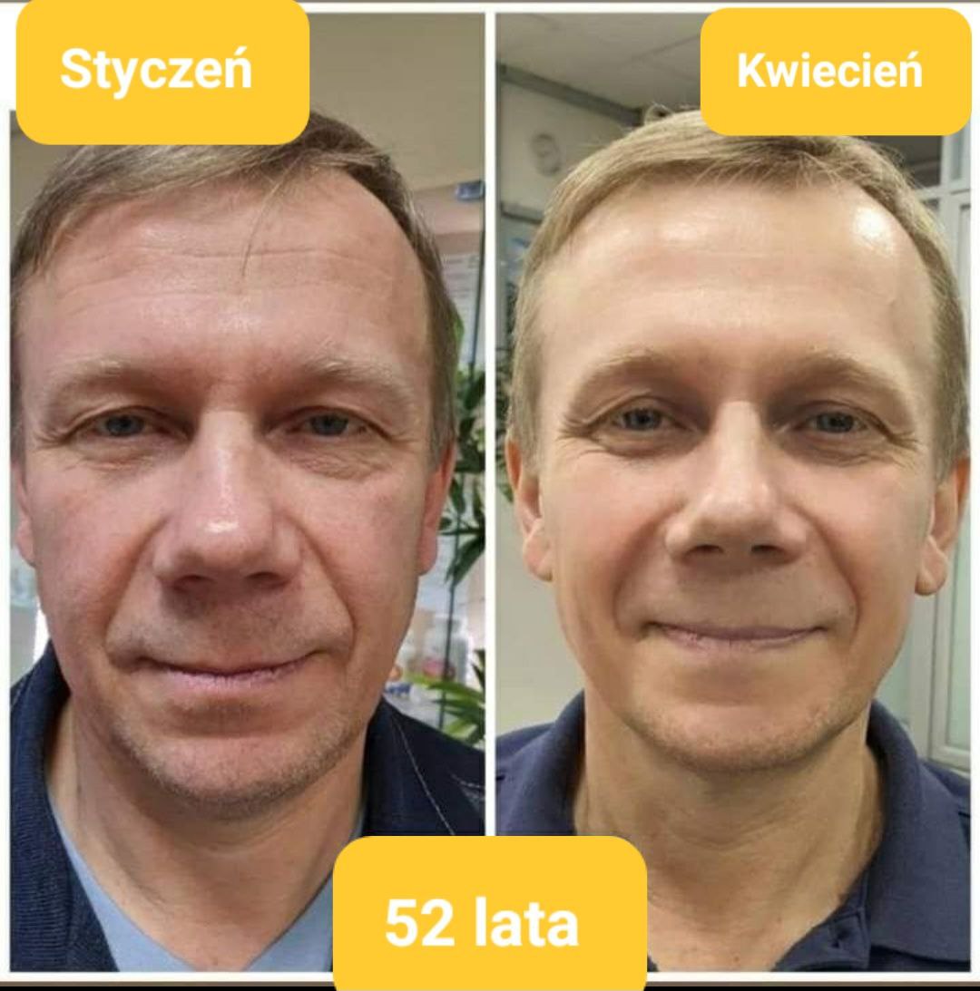 Efekty Promarine Collagen Peptides Coral Club Efekty Promarine Collagen Peptides Coral Club