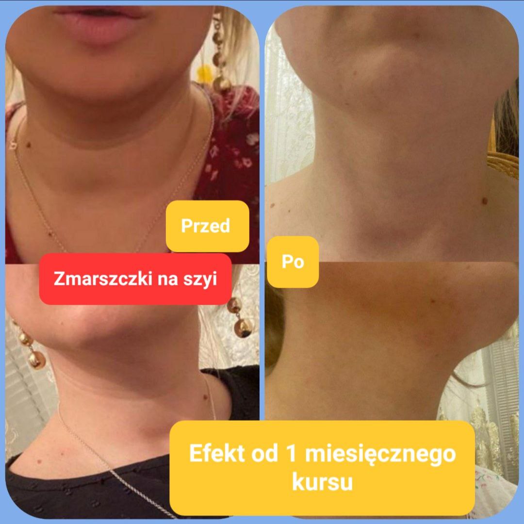 Efekty Promarine Collagen Peptides Coral Club Efekty Promarine Collagen Peptides Coral Club