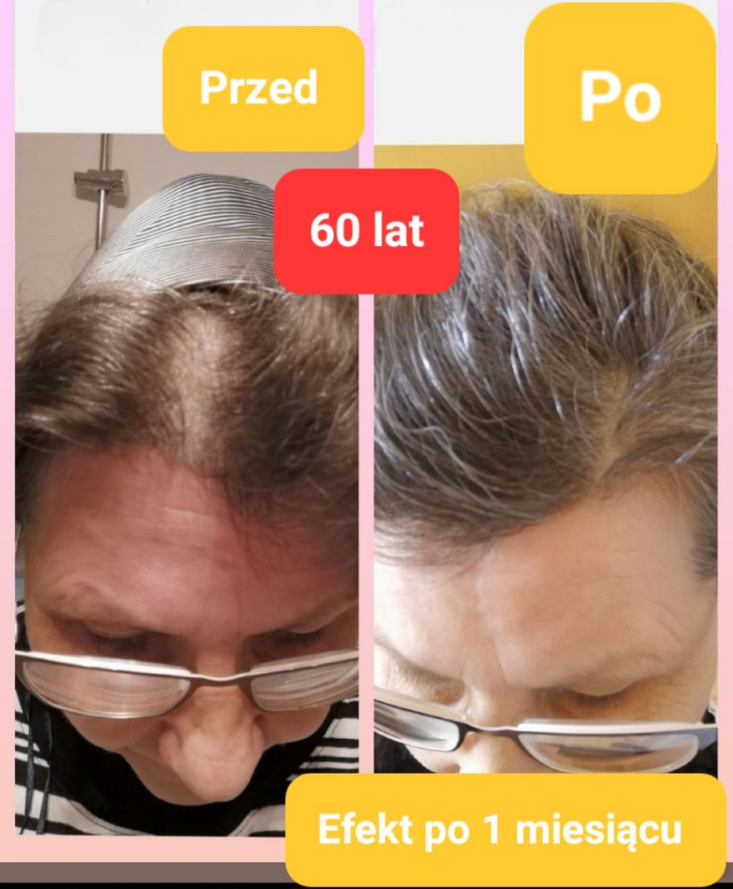 Efekty Promarine Collagen Peptides Coral Club Efekty Promarine Collagen Peptides Coral Club