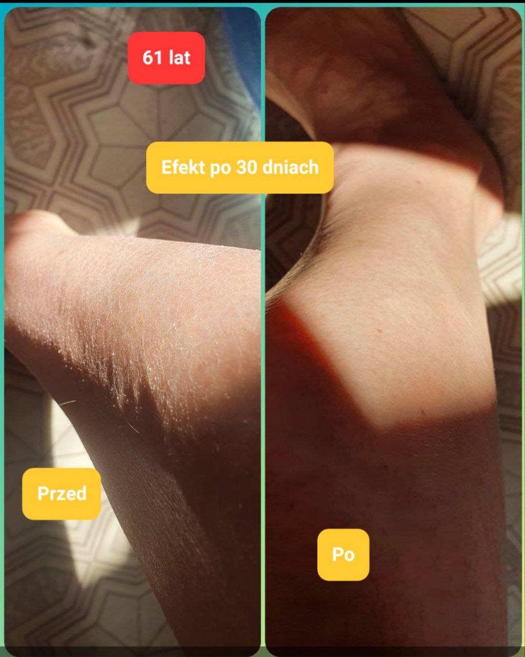 Efekty Promarine Collagen Peptides Coral Club Efekty Promarine Collagen Peptides Coral Club