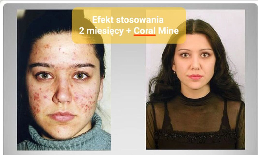 Efekty Colo Vada Coral Ckub